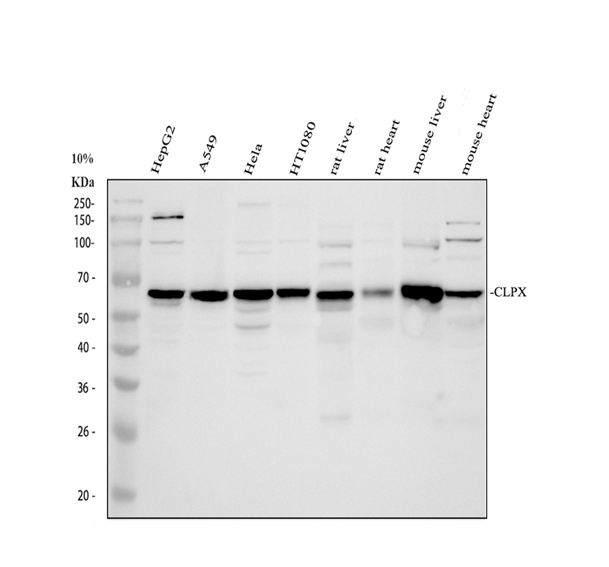 Western blot analysis of CLPX using anti-CLPX antibody (A00978-1)