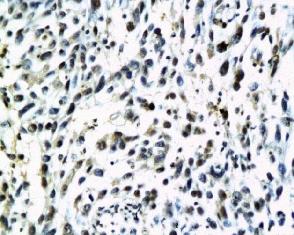 a00979 s100b primary antiboties ihc testing 2