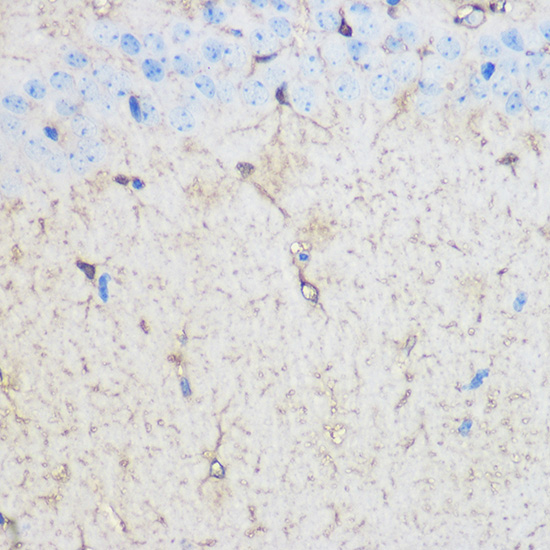 Immunohistochemistry of paraffin-embedded Mouse brain using S100β pAb at dilution of 1:100 (40x lens)