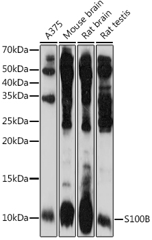 Western blot analysis of extracts of various cell lines, using S100β pAb at 1:1000 dilution