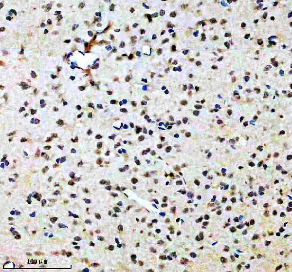 IHC analysis of TWIST1 using anti-TWIST1 antibody (A00980-2)