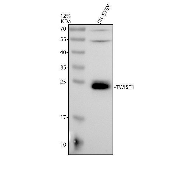 Western blot analysis of TWIST1 using anti-TWIST1 antibody (A00980-2)