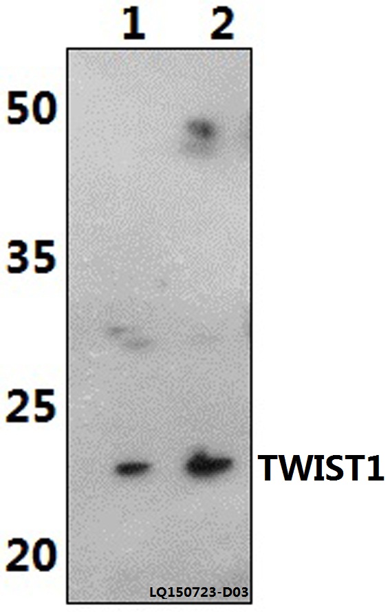 a00980 twist1 primary antiboties wb testing 1