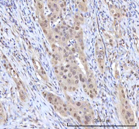  IHC analysis of RANBP2 using anti-RANBP2 antibody (A00981-1)