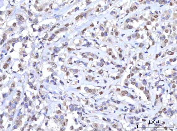  IHC analysis of RANBP2 using anti-RANBP2 antibody (A00981-1)