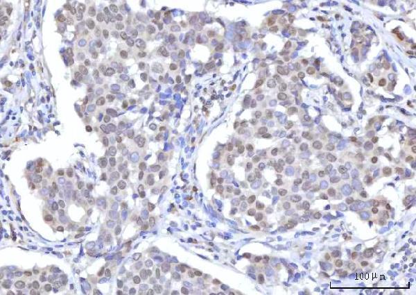 a00981 1 ranbp2 primary antibodies ihc testing 4