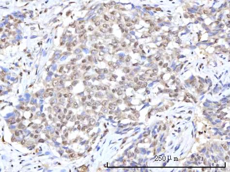 a00981 1 ranbp2 primary antibodies ihc testing 5