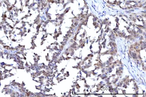 a00981 1 ranbp2 primary antibodies ihc testing 6