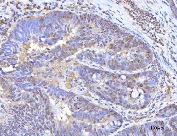 a00981 1 ranbp2 primary antibodies ihc testing 7
