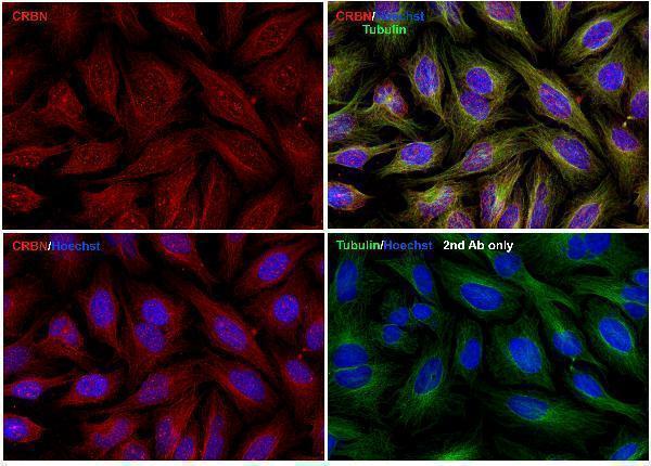 a00983 crbn primary antibodies if testing 1