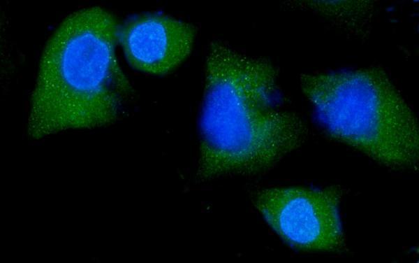 a00984 3 nedd4 primary antibodies if testing 7