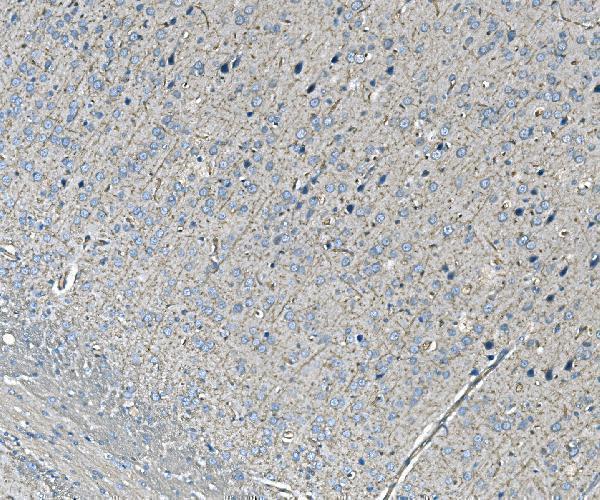  IHC analysis of NEDD4 using anti-NEDD4 antibody (A00984-3)