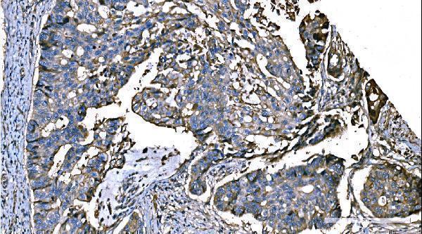 a00984 3 nedd4 primary antibodies ihc testing 3