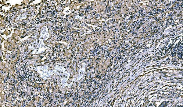 a00984 3 nedd4 primary antibodies ihc testing 5