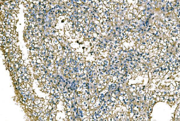 a00984 3 nedd4 primary antibodies ihc testing 6