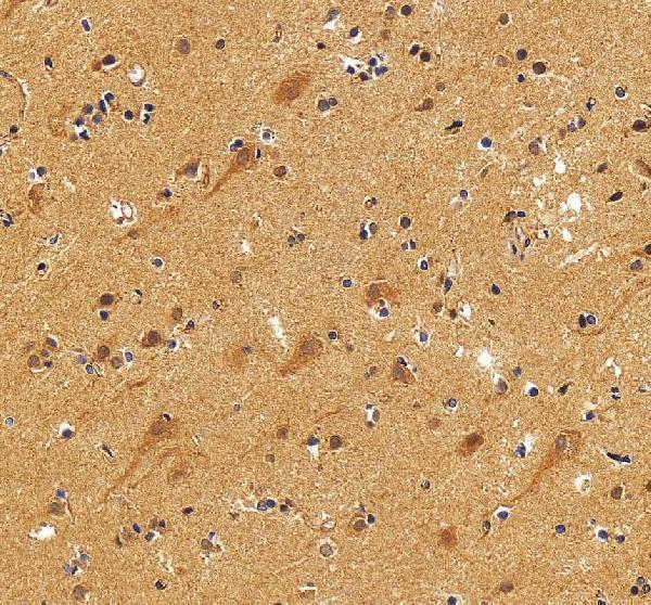 IHC analysis of NEDD4 using anti-NEDD4 antibody (A00984-3)