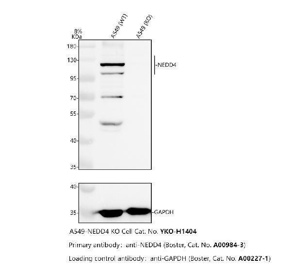 Western blot analysis of NEDD4 using anti-NEDD4 antibody (A00984-3)