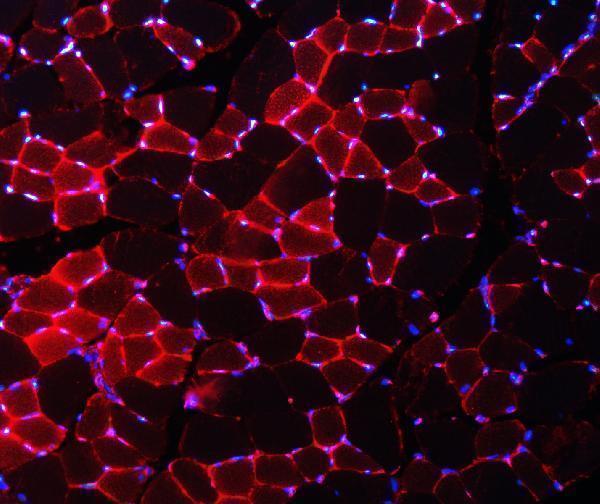 a00984 4 nedd4 primary antibodies if testing 7