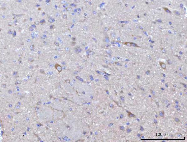  IHC analysis of Nedd4 using anti-Nedd4 antibody (A00984-4)