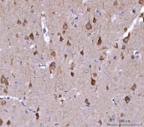 a00984 4 nedd4 primary antibodies ihc testing 5