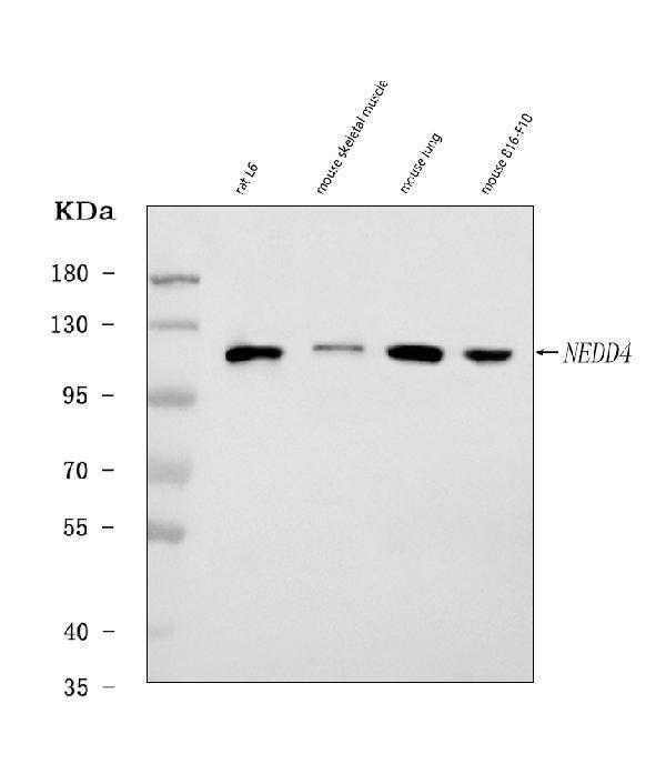  Western blot analysis of Nedd4 using anti-Nedd4 antibody (A00984-4)
