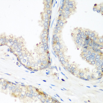 Immunohistochemistry of paraffin-embedded human prostate using NEDD4 antibody  at dilution of 1:200 