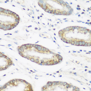 Immunohistochemistry of paraffin-embedded human gastric using NEDD4 antibody  at dilution of 1:200 