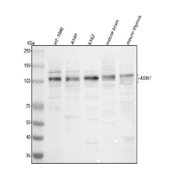  Western blot analysis of AXIN1 using anti-AXIN1 antibody (A00986-2)