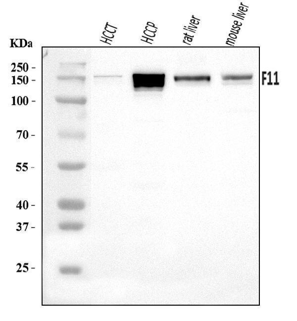  Western blot analysis of FXI/F11 using anti-FXI/F11 antibody (A00989-1)