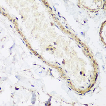 Immunohistochemistry of paraffin-embedded human colon using Caveolin-3  antibody  at dilution of 1:200 