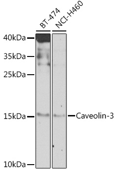 Western blot analysis of extracts of various cell lines, using Caveolin-3  antibody  at 1:1000 dilution
