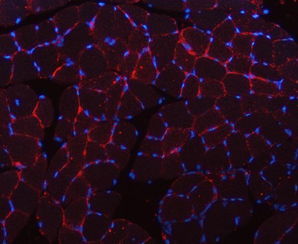a00990 2 cav3 primary antibodies if testing 4_1