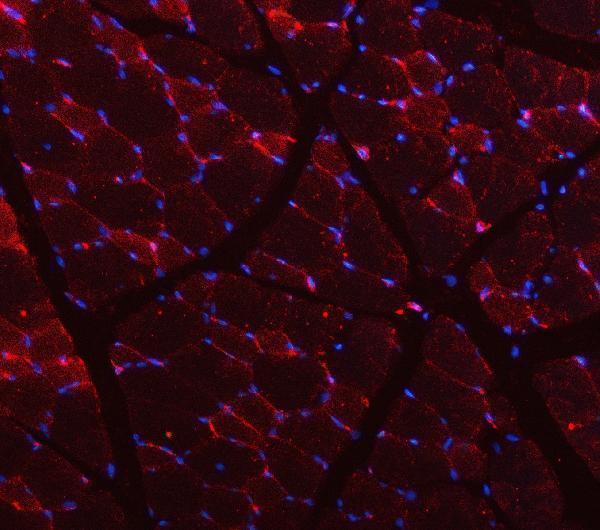 a00990 2 cav3 primary antibodies if testing 5_1