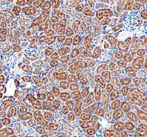 IHC analysis of uPA Receptor using anti-uPA Receptor antibody (A00993-2)