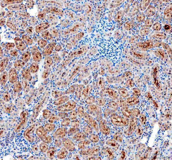 IHC analysis of uPA Receptor using anti-uPA Receptor antibody (A00993-2)