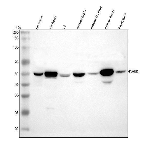 Western blot analysis of uPA Receptor using anti-uPA Receptor antibody (A00993-2)