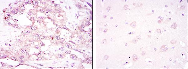 Immunohistochemistry analysis of paraffin-embedded ovarian cancer (left) and brain tissues (right) with DAB staining using AMPKα1 Monoclonal Antibody