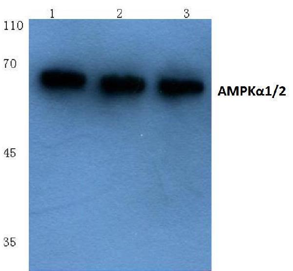 Western blot (WB) analysis of AMPKα1/2 (D168) polyclonal antibody at 1:500 dilution
Lane1:PC12 whole cell lysate(40ug)
Lane2:CT26 whole cell lysate(40ug)
Lane3:MCF-7 whole cell lysate(40ug)
Lane4:A549 whole cell lysate(40ug)
Lane5:Hela whole cell lysate(40ug)