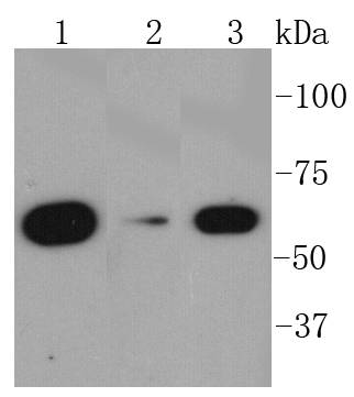 Western blot analysis of AMPK alpha 1 on different lysates using anti-AMPK alpha 1 antibody at 1/1,000 dilution