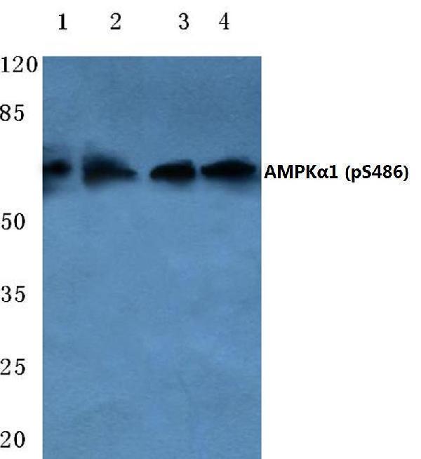 Western blot (WB) analysis of p-AMPKα1 (S486) polyclonal antibody at 1:500 dilution
Lane1:HEK293T cell lysate treated with UV
Lane2:sp2/0 cell lysate treated with UV
Lane3:PC12 cell lysate treated with UV