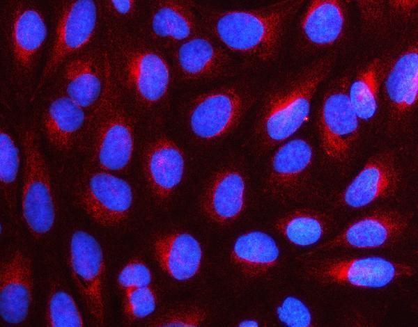  IF analysis of NUDC using anti-NUDC antibody (A00995-1)