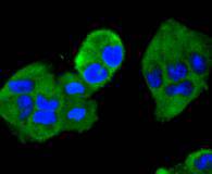 ICC staining MEK2 in Hela cells (green)