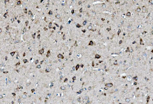 a00996 2 map2k2 primary antibodies ihc testing 8