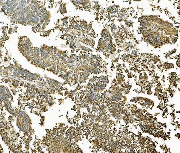 a00996 2 mek2 primary antibodies ihc testing 2