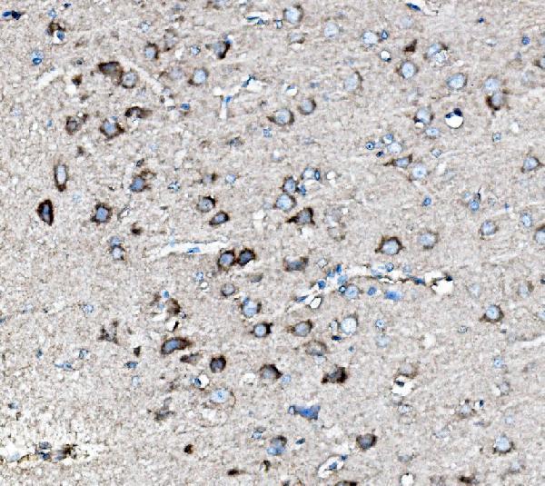 a00996 2 mek2 primary antibodies ihc testing 3