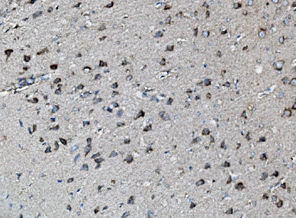 a00996 2 mek2 primary antibodies ihc testing 4