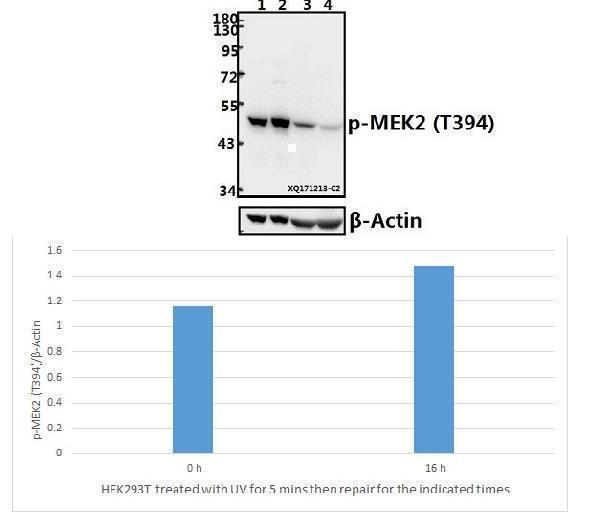 Western blot (WB) analysis of p-MEK2 (T394) pAb at 1:2000 dilution
Lane1:HEK293T whole cell lysate(40ug)
Lane2:HEK293T treated with UV for 5 minutes then repair for 16 hours whole cell lysate(40ug)
Lane3:The Kidney tissue lysate of Rat(40ug)
Lane4:The Kidney tissue lysate of Mouse(40ug)