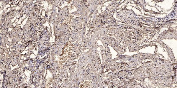 a01000 1 mbl2 primary antibodies ihc testing 1