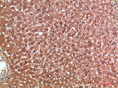 Immunohistochemical analysis of paraffin-embedded human-liver, antibody was diluted at 1:200