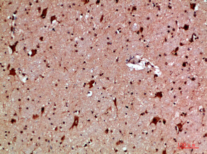 Immunohistochemical analysis of paraffin-embedded human-brain, antibody was diluted at 1:200